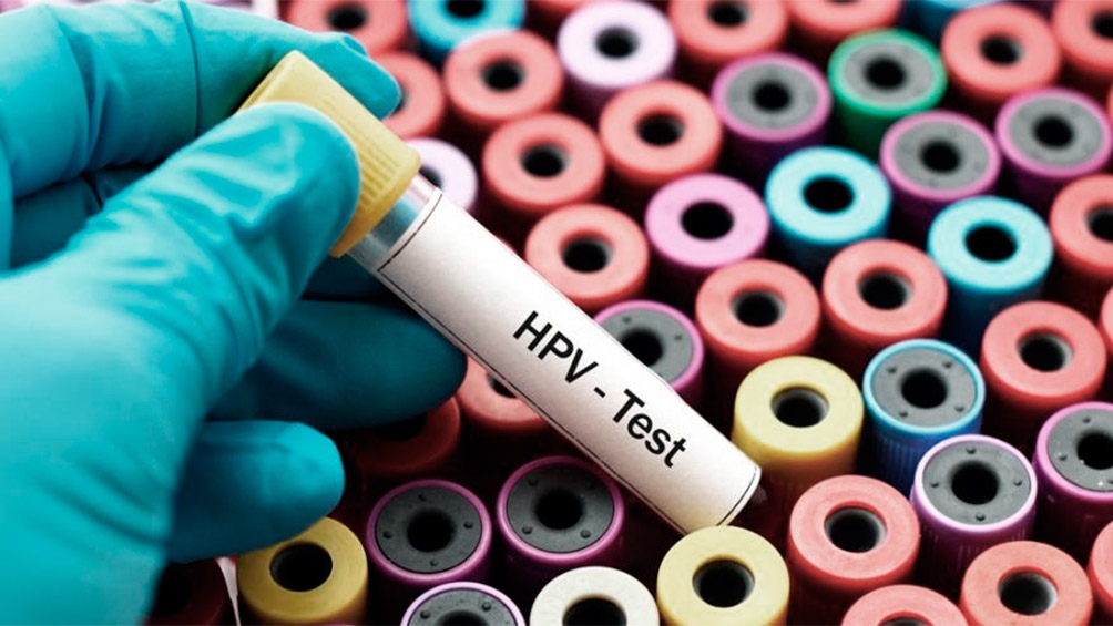 Pruebas de laboratorio para el VPH (HPV). Foto: fuentes/rerencial.