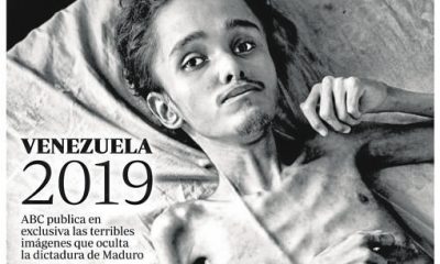 ACN Hambruna en Venezuela