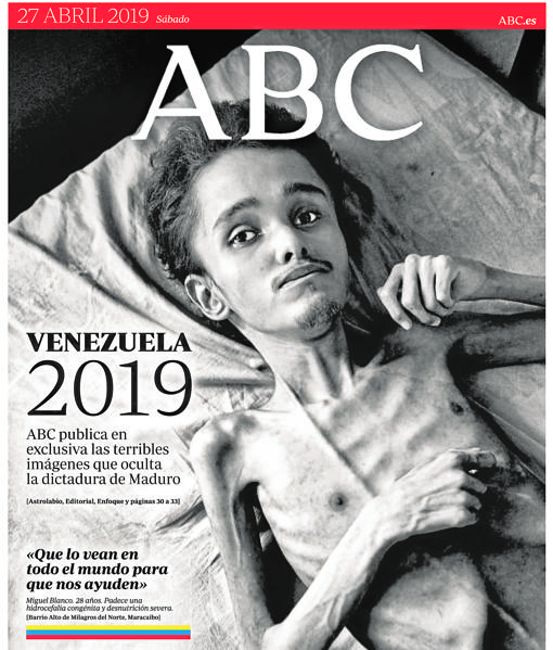 ACN Hambruna en Venezuela