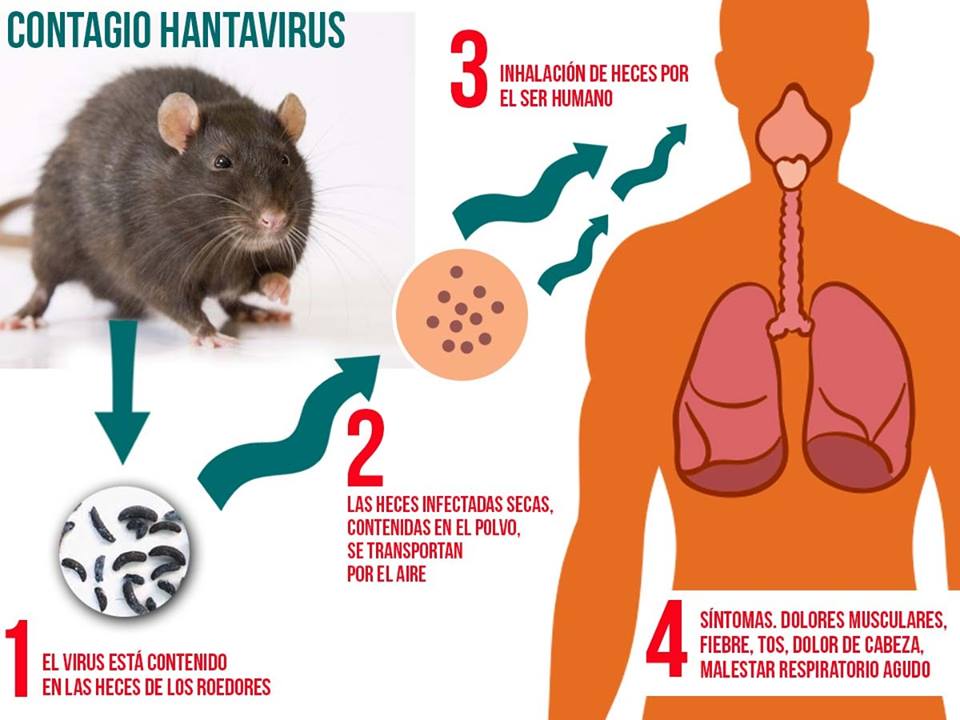 Los síntomas del virus Hanta que produce el síndrome HPS. Foto: fuentes.