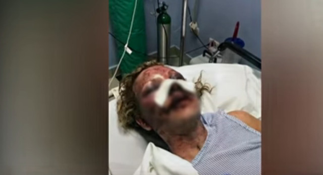 Tammy Lawrence-Daley, publicó una foto en Facebook mostrando su rostro hinchado y magullado luego del ataque. Foto: fuentes.