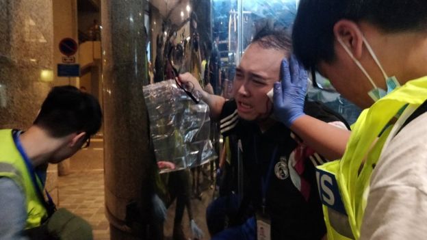 El concejal Andrew Chiu Ka-yin, cuya oreja fue cortada. Foto: fuentes.