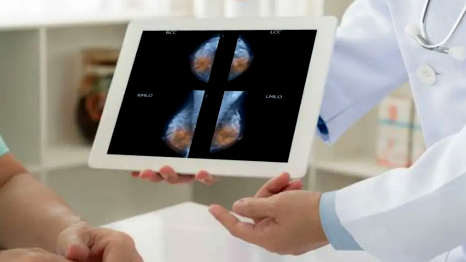 Cura para la metástasis - acn