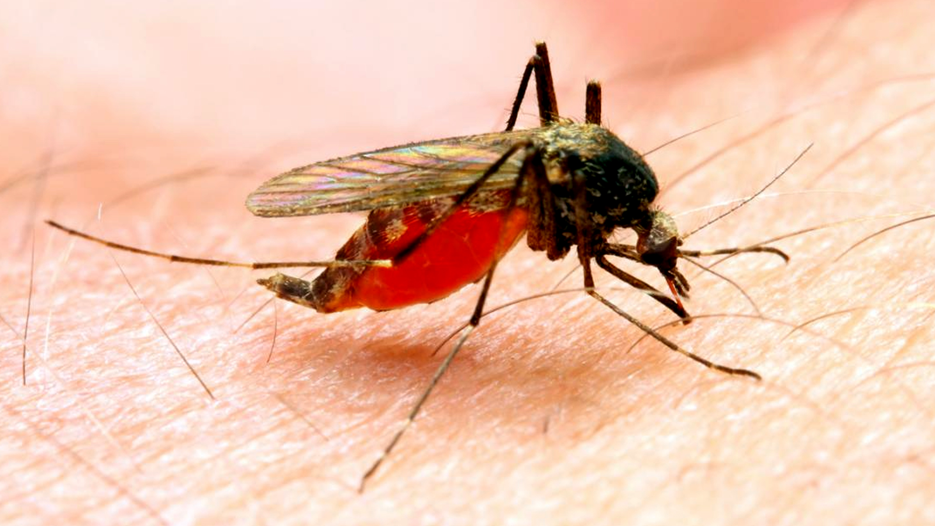 Casos de malaria en carabobo - ACN
