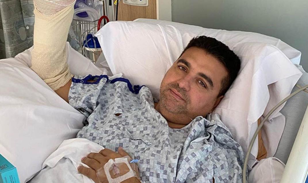 Chef Buddy tuvo que someterse a cirugía después de un accidente