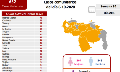 Venezuela acumuló 679 casos - noticiasACN