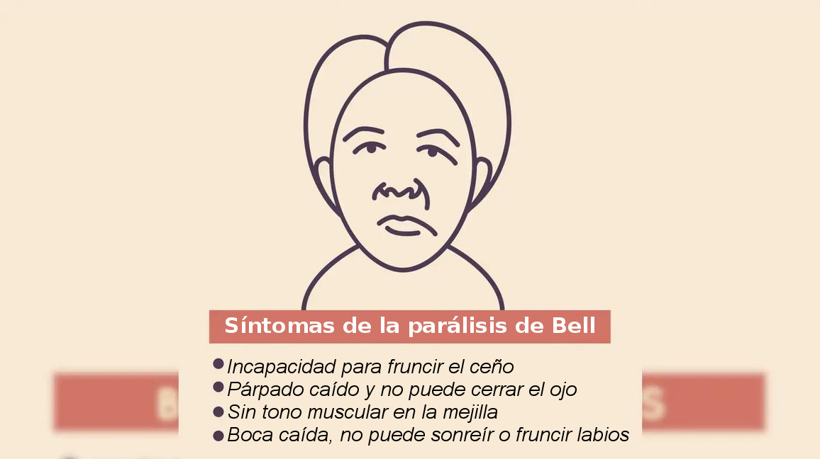 ¿Que hay detrás de los casos de parálisis facial en algunos vacunados con la anticovid?