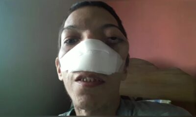 Paciente con cáncer