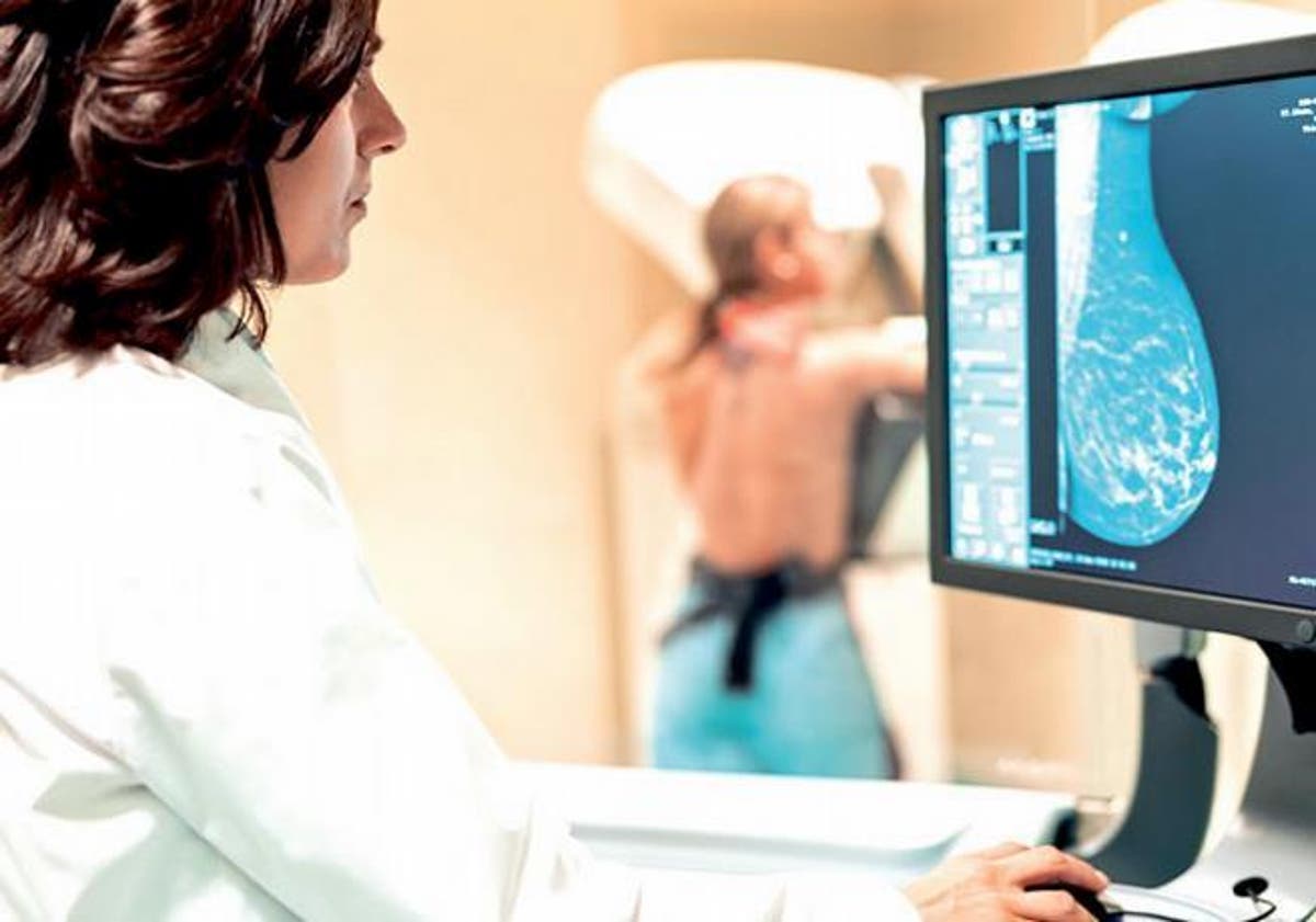 hormona masculina cáncer de mama- acn