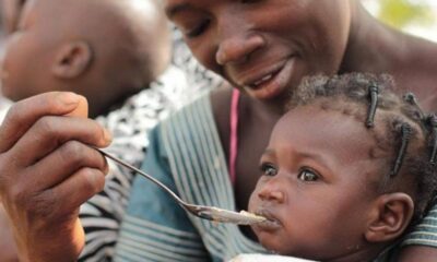 millones de niños con desnutrición- acn