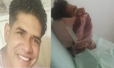 Venezolano herido en Bogotá - ACN