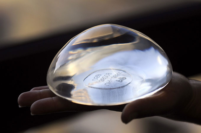 Indemnización implantes PIP - ACN