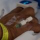 Falleció paciente hongo negro en México - ACN