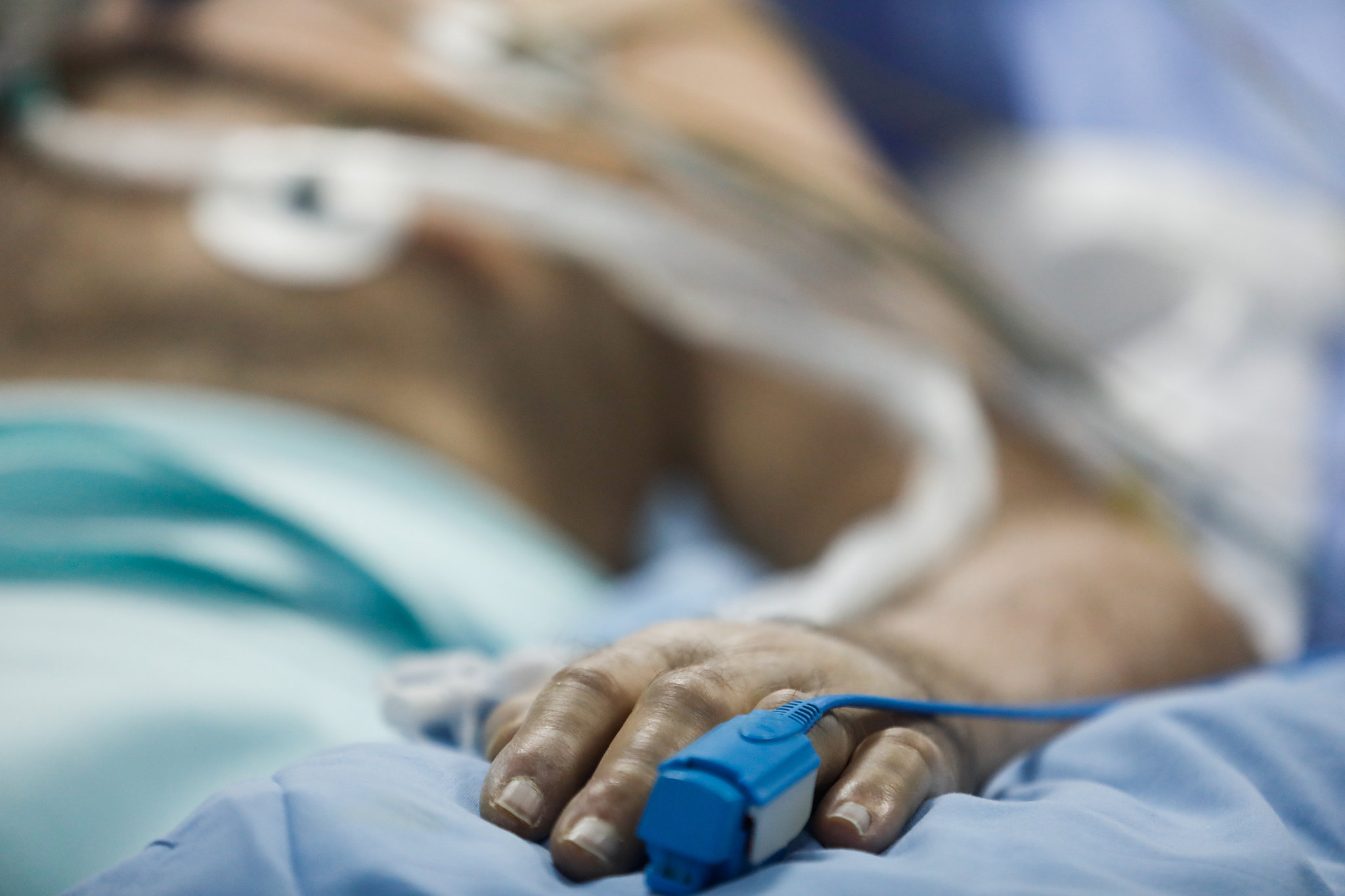 sin oxígeno pacientes coro- acn