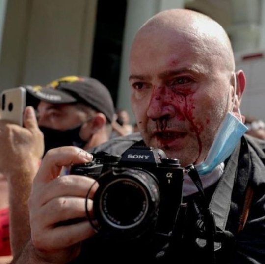 sip agresiones periodista cuba- acn