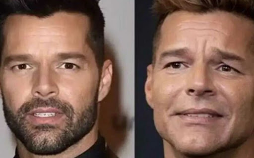 Ricky Martin explicó el cambio en su rostro