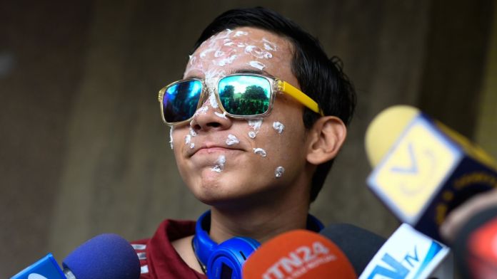 Condenan a policías que dejaron ciego a Rufo Chacón - noticiacn