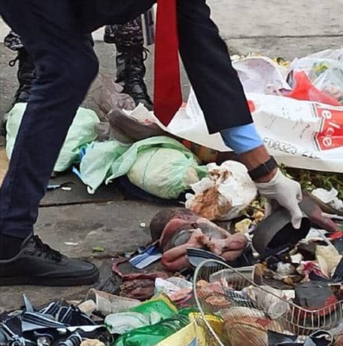 localizan cuerpo de recién nacido en Caracas-acn