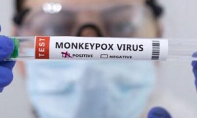 OMS no recomienda vacunaciones masivas contra la viruela del mono