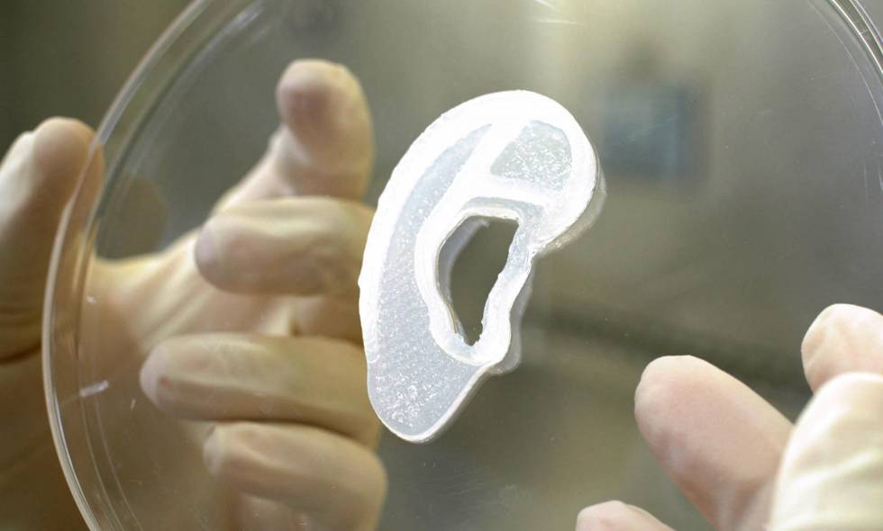 oreja impresora 3D - ACN