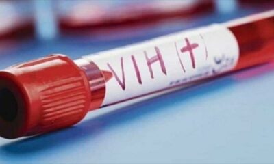 detección y tratamiento de VIH y tuberculosis - noticiacn