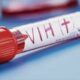detección y tratamiento de VIH y tuberculosis - noticiacn